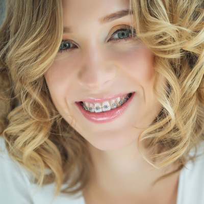 A woman with a broad smile, showing her braces and teeth, against a white background.