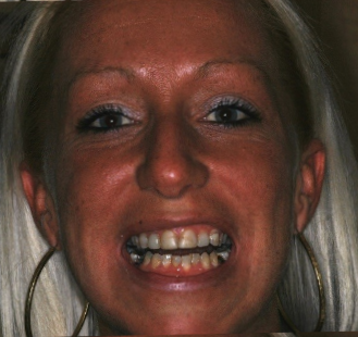Dental Images in Hackensack